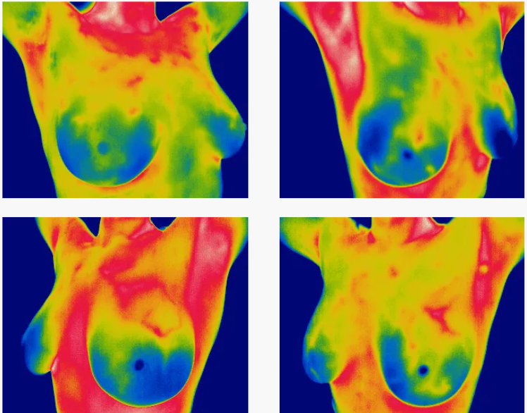 Sample Thermocheck thermal imaging scans